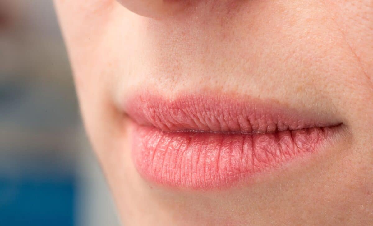 Cracked Lips in the Cold Discover How This Kitchen Ingredient Can Heal Them in Just One Night!