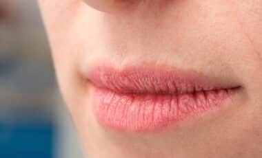 Cracked Lips in the Cold Discover How This Kitchen Ingredient Can Heal Them in Just One Night!