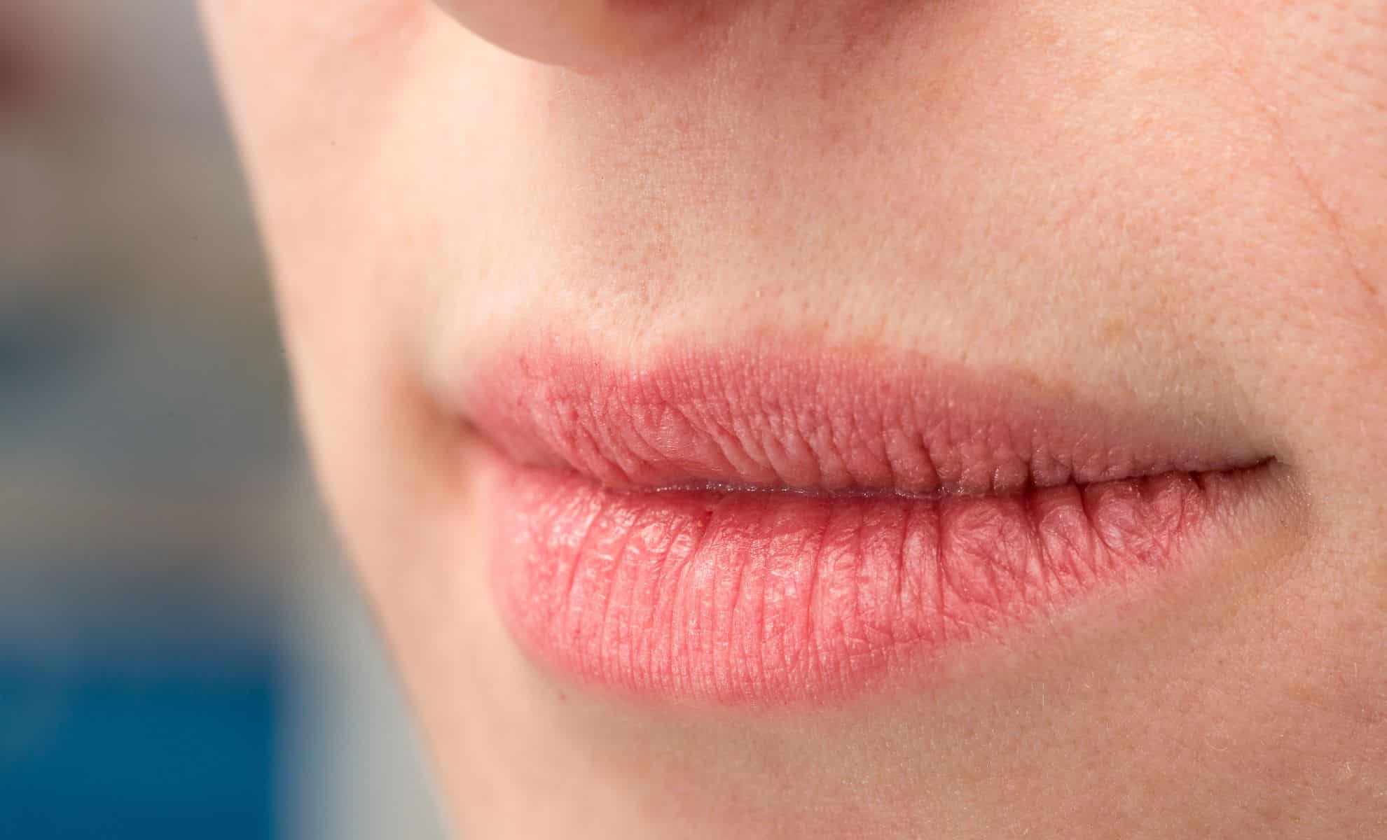Cracked Lips in the Cold Discover How This Kitchen Ingredient Can Heal Them in Just One Night!